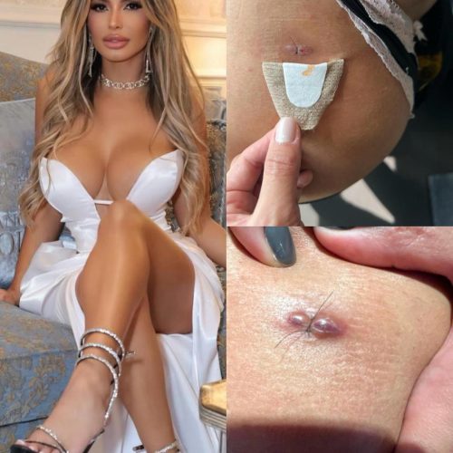 Influencer com título de “Mulher perfeita” de acordo com a IA mostra estragos do chip da beleza, veja fotos